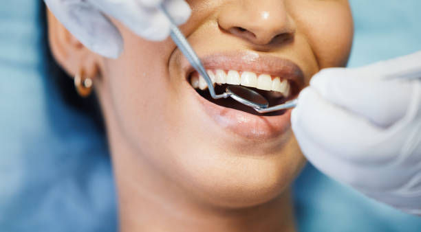 Best Emergency Gum Treatment in Grass Valley, CA